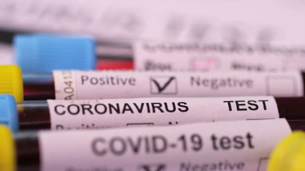 Coronavirus Covid Εξέταση Αίματος Μακροσκοπικό Κοντινό Πλάνο Θετικά Αρνητικά Αποτελέσματα — Αρχείο Βίντεο