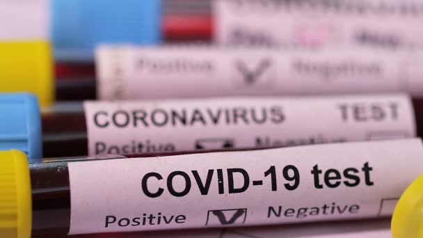 Koronawirus Badanie Krwi Covid Makro Zbliżenie Koronawirus Ncov Wynik Dodatni — Wideo stockowe