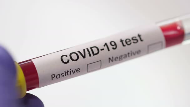 Coronavirus Covid 19血液检测宏观特写拍摄 Coronavirus Ncov检测阳性阴性结果 医疗录像 标记血液检测的概念 Sars Mers Flu — 图库视频影像