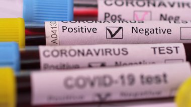 close-up of Covid Test blood samples in test tubes