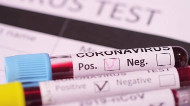 close-up of Covid Test blood samples in test tubes