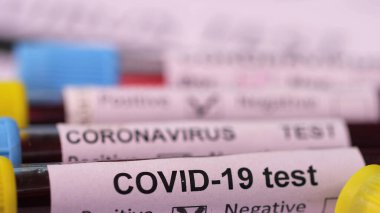close-up of Covid Test blood samples in test tubes