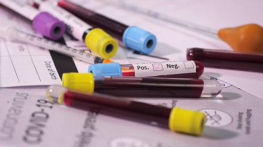 close-up of Covid Test blood samples in test tubes
