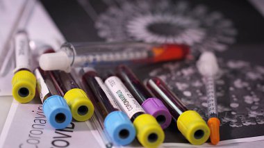 close-up of Covid Test blood samples in test tubes