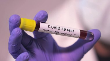 medical concept, positive covid-19 test 