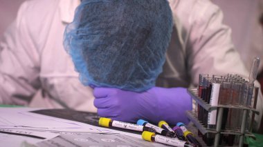 tired Doctor Sleeping at work, coronavirus pandemic 