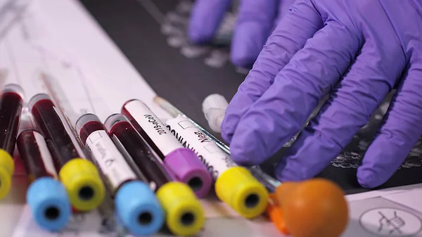 Close Test Tubes Blood Samples Covid Tests lizenzfreie Stockbilder