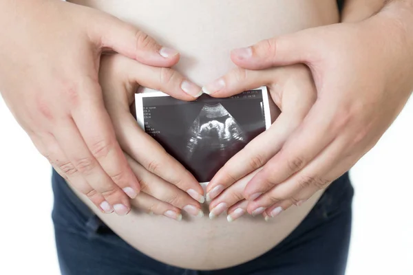 Imagem de close-up da mulher grávida e marido segurando ultra-som f — Fotografia de Stock