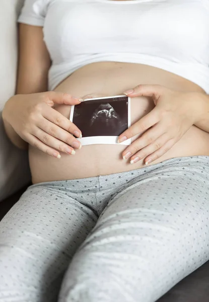 Foto de primer plano de la mujer embarazada sosteniendo la imagen de ultrasonido — Foto de Stock