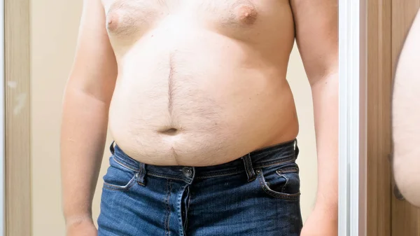 Półnagi człowieka w dżinsy z wielkim brzuchem — Zdjęcie stockowe