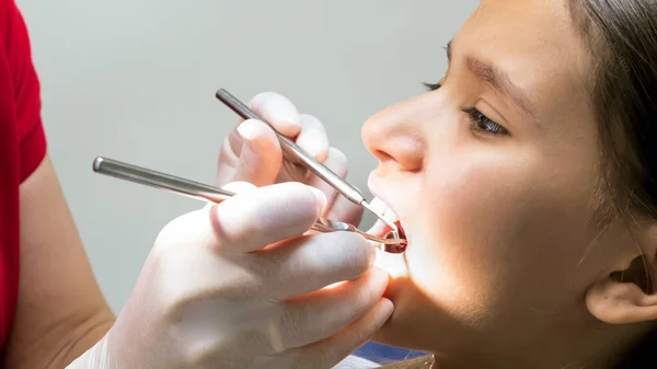 Foto de close-up do dentista inspecionando dentes de crianças com instumentos especiais — Fotografia de Stock