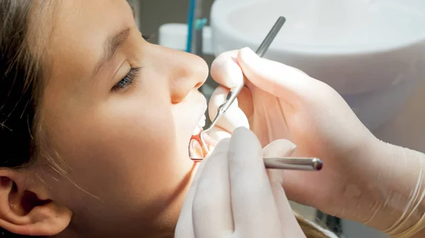 Portret van meisje opent haar mond wijd voor tandarts treting haar tanden — Stockfoto