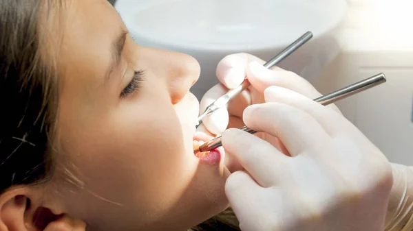 Close-up beeld van tandarts inspectie van tienermeisjes tanden met speciale tandheelkundige instrumenten — Stockfoto