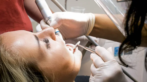 Крупним планом зображення молодої жінки відкриває рот під час зубного нальоту стоматолога — стокове фото