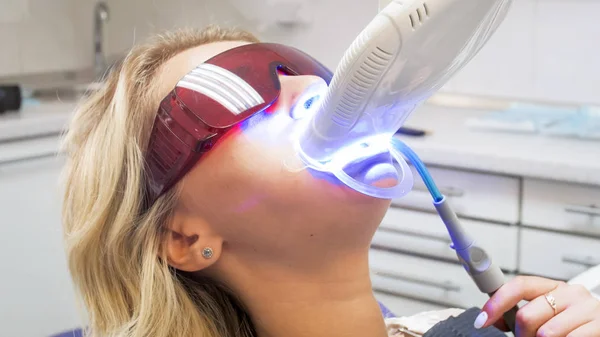 Closeup portret van de jonge vrouw zitten in de tandarts stoel tijdens tanden whitening met UV-licht — Stockfoto