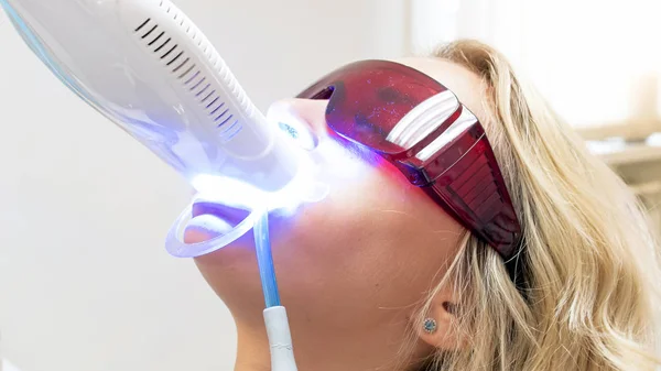 Zbliżenie obrazu specjalne lampy światła Uv do zębów Wybielanie w jamy ustnej u pacjentów — Zdjęcie stockowe