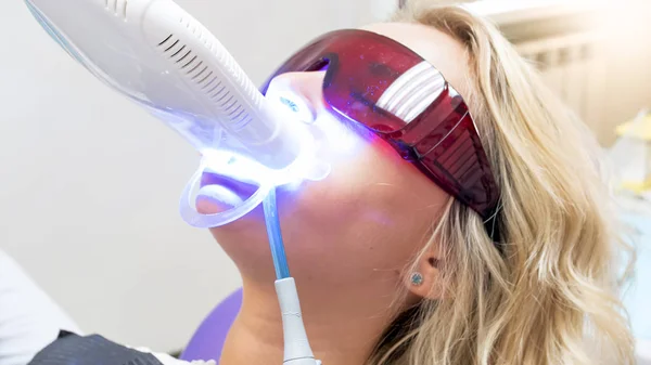 Imagen de primer plano del procedimiento de blanqueamiento de dientes con luz UV — Foto de Stock