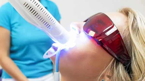 Closeup portret van de jonge vrouw istting in het kantoor van de tandarts tijdens tanden whitening — Stockfoto
