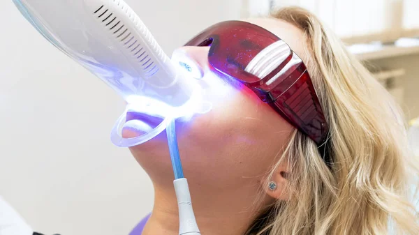 Closeup portret van youn gblonde vrouw zitten in de tandarts stoel tijdens tanden whitening procedure met fotopolymeer — Stockfoto