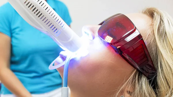 Close-up beeld van jonge blonde vrouw beschermende oranje bril tijdens tanden whitening met UV-licht — Stockfoto