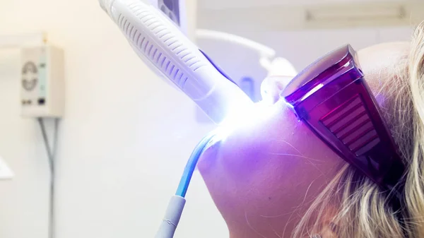 Крупним планом зображення процедури відбілювання зубів з використанням ультрафіолетового світла — стокове фото
