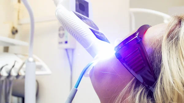 Close-up beeld van jonge blonde vrouw patiënt in het kantoor van de tandarts om tanden whitening procedure — Stockfoto