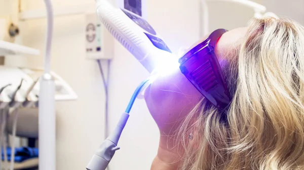 Closeup portret van de jonge blonde vrouw tijdens tanden whitening procedure in het kantoor tandarts — Stockfoto