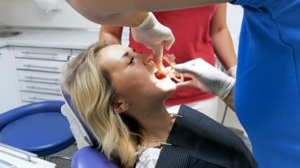 4k filmato del dentista che inserisce un apposito allargatore della bocca nella bocca dei pazienti — Video Stock