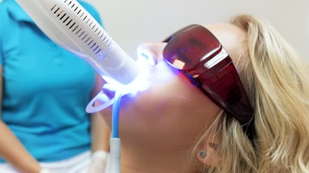 Closeup 4k πλάνα του λεύκανση δοντιών διαδικασία σε σύγχρονο οδοντιατρείο — Αρχείο Βίντεο