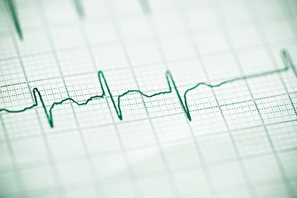 Electrocardiogram close up — Stock Photo, Image