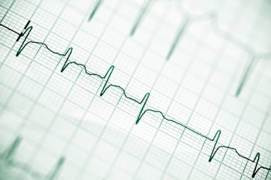 Elektrokardiyogram yakın çekim