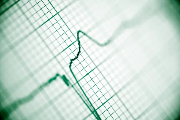 Electrocardiogram close up — Stock Photo, Image