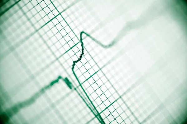 Electrocardiogram close up. — Stock Photo, Image