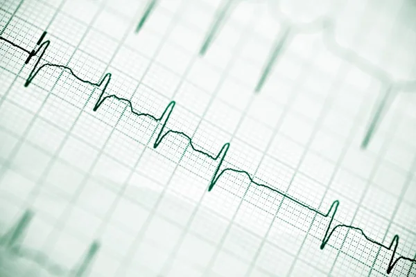 Elektrocardiogram close-up. — Stockfoto