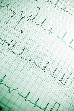 Elektrokardiyogram yakın çekim