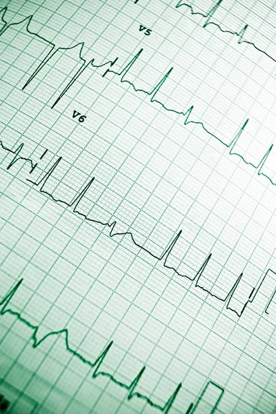 Electrocardiogram close up — Stock Photo, Image