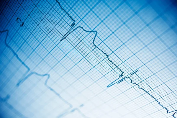 Electrocardiogram close up — Stock Photo, Image