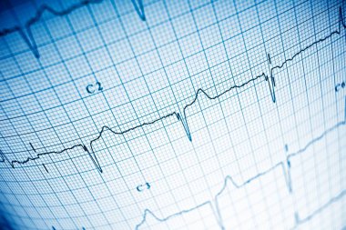 Elektrokardiyogramı kağıt formunda kapat.