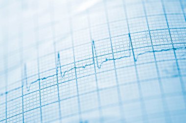 Elektrokardiyogram yakın çekim