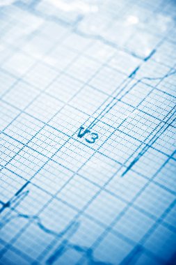 Elektrokardiyogram yakın çekim