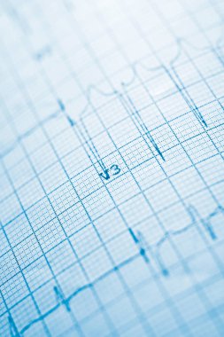 Elektrokardiyogram yakın çekim