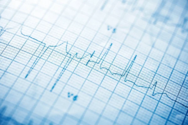 Electrocardiograma de cerca —  Fotos de Stock