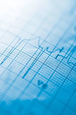 Elektrokardiyogram yakın çekim