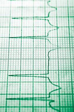 Elektrokardiyogram yakın çekim