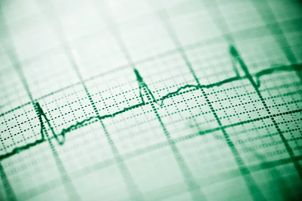 Elektrokardiogramm aus nächster Nähe — Stockfoto