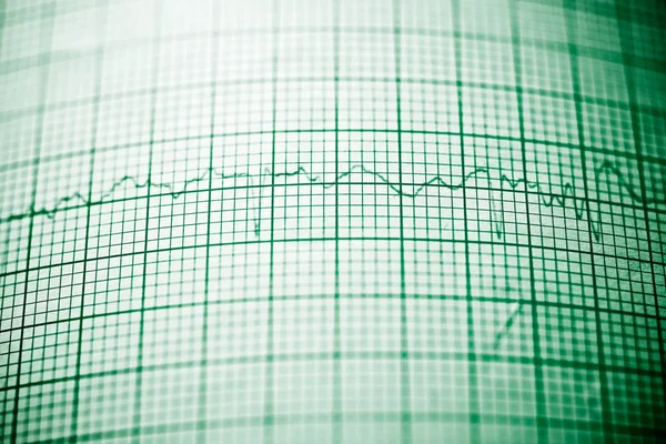 심전도 닫습니다. — 스톡 사진