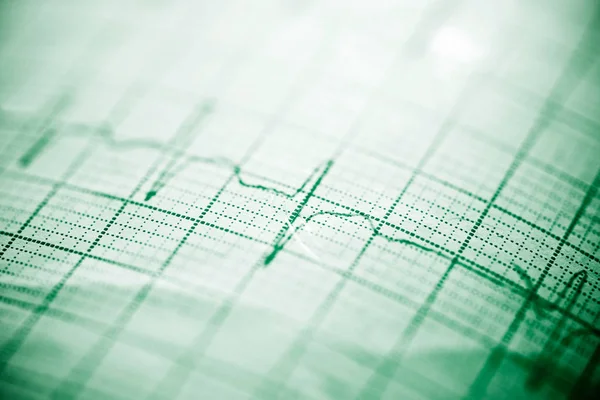 EKG közelről — Stock Fotó