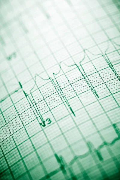 Eletrocardiograma de perto — Fotografia de Stock