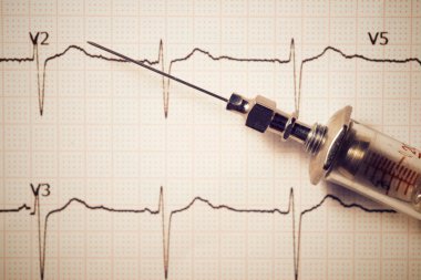 Elektrokardiyogram kağıdındaki eski bir şırınganın yakın çekimi.