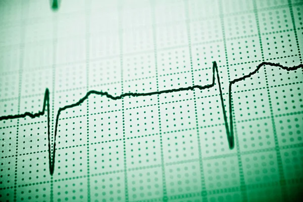 Primer Plano Electrocardiograma Forma Papel —  Fotos de Stock